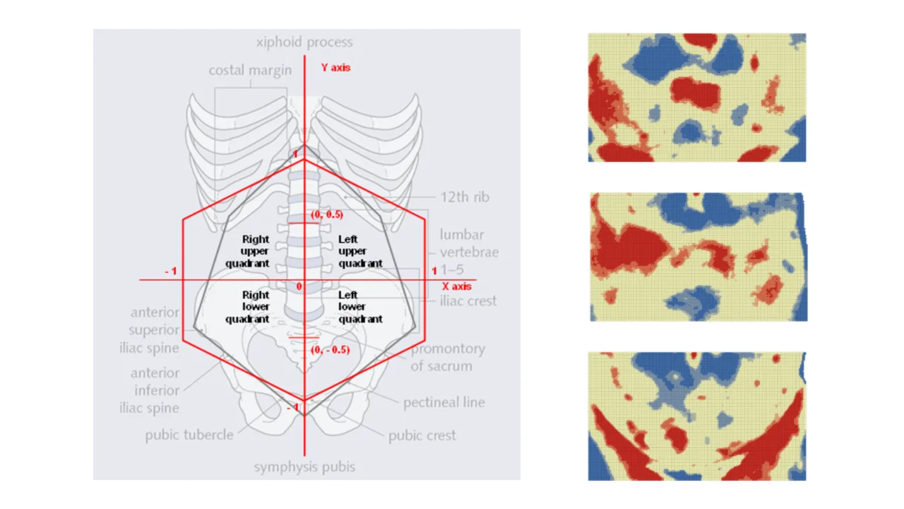 Mapping the Abdominal Wall for Spatial Pattern Estimation